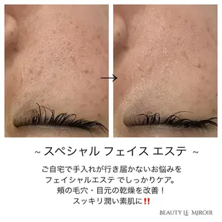 ビューティー ミロワールのエステ・リラクイメージ