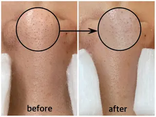 韓国肌管理 【毛穴専科】のエステ・リラクイメージ