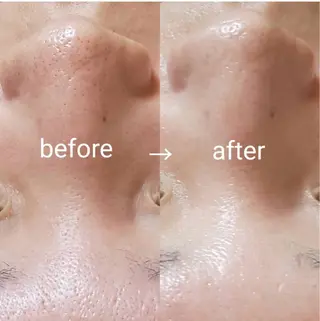 Luce所属・Luce Shokoのエステ・リラクイメージ