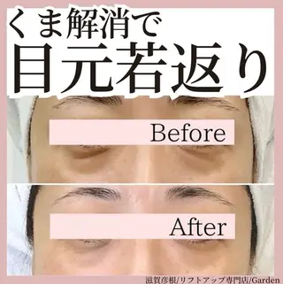 リフトアップ専門店 Gardenこやまのエステ・リラクイメージ