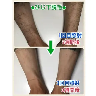 メンズ キッズ メンズ脱毛サロンBiSTA所属・BiSTA ヒロのエステ・リラクイメージ