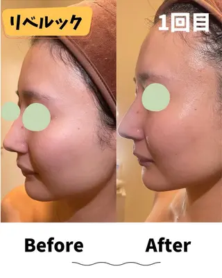 コンセプトサロン〜友〜所属・コンセプトサロン友 木下のエステ・リラクイメージ