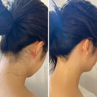 うなじ脱毛/美肌脱毛 LABELのエステ・リラクイメージ