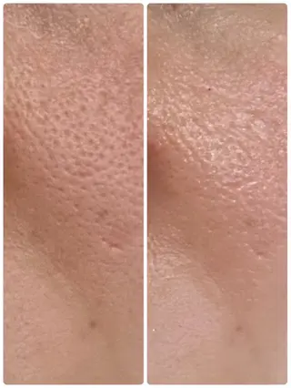 メナード宮の沢店所属・メナード宮の沢店 コトコのエステ・リラクイメージ