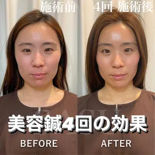 ロング カラー パーマ ヘアアレンジ メンズ ネイル マツエク・マツパ アイブロウ 即小顔♥️美容鍼× ハーブピーリングのその他イメージ