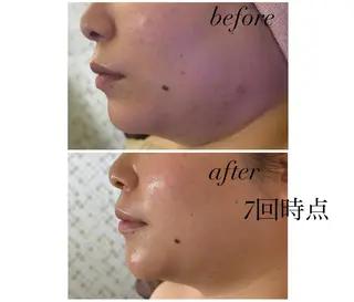 《美肌&小顔サロン》 Masqueradeのエステ・リラクイメージ