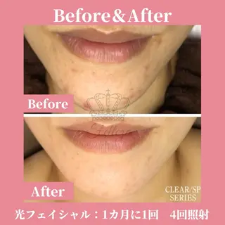 有人型セルフサロン 脱毛/痩身/美顔のその他イメージ