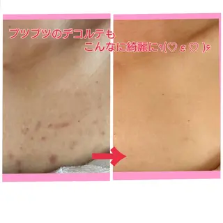 ハーブピーリング 専門店Kikkaのエステ・リラクイメージ