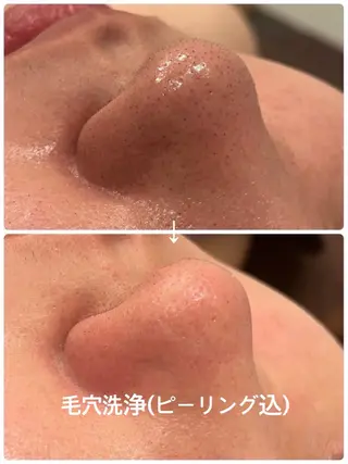 LEPUS【レプス】 sekiのエステ・リラクイメージ