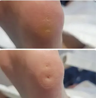 福岡巻き爪補正店 博多店のエステ・リラクイメージ