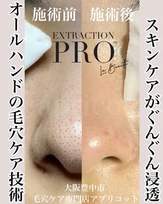 ヘッドスパ専門/豊中 apricotのエステ・リラクイメージ