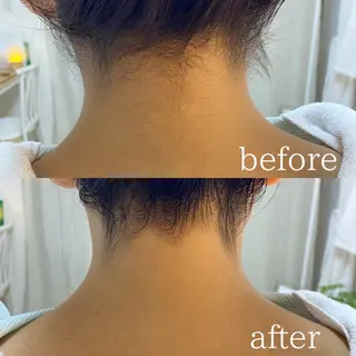 AKALA hitomiのエステ・リラクイメージ