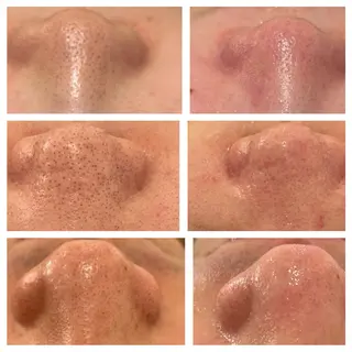 ANERA Second所属・尾上 沙織のエステ・リラクイメージ