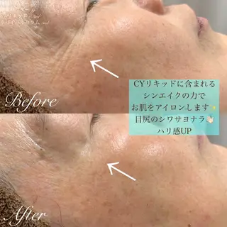 one day所属・肌質改善ハーブサロン ALA原宿のエステ・リラクイメージ