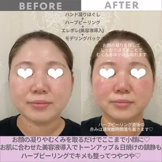 リンデザ 山口のエステ・リラクイメージ