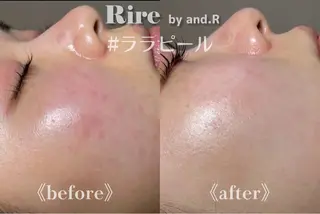 実方 梨々花のエステ・リラクイメージ