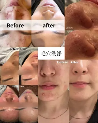 💎美容革命ラボ💎 大名店のエステ・リラクイメージ