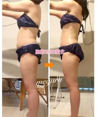 ショート カラー パーマ ヘアアレンジ メンズ キッズ ネイル マツエク・マツパ ‍痩身＆ボディ 結果出し🌟丹野のエステ・リラクイメージ