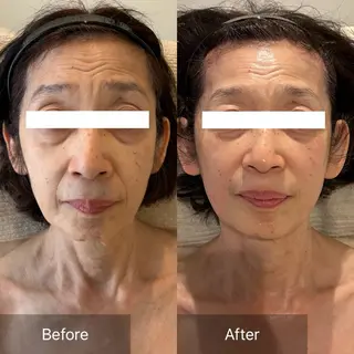 Charis エステ&ネイルのエステ・リラクイメージ