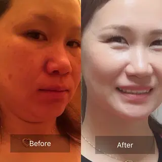 ヨサパーク  ルフ楢原店所属・水素×よもぎ蒸し YOSAPARKルフのエステ・リラクイメージ