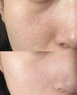 アイブロウ 愛維美水光美肌専門店所属・愛維美水光美肌専門店 メンズレディースokのエステ・リラクイメージ