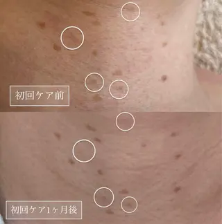 LUMY GRATiAEのエステ・リラクイメージ