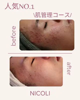 エステサロン NICOLIのエステ・リラクイメージ