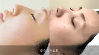 小顔とシミケア🪽 /Salon Mのエステ・リラクイメージ