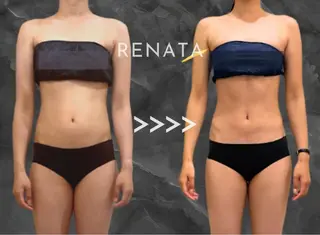 脂肪冷却専門店 RENATA新宿のエステ・リラクイメージ