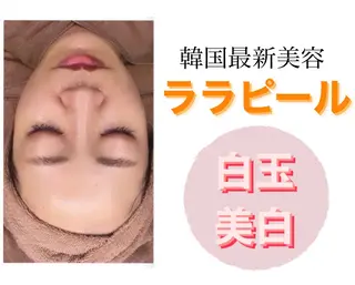 White Calm 天王寺所属・ハーブピーリング White Calmのその他イメージ