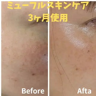 結果が出るスキンケア 肌質改善/まつパのエステ・リラクイメージ