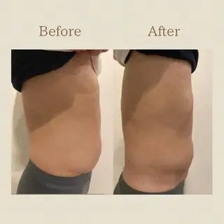 お腹痩せエステ Flat BELLY 恵比寿所属・【腸もみ/冷却痩身】 お腹エステ/恵比寿のエステ・リラクイメージ