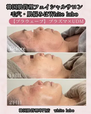 韓国肌管理専門店　White labo 梅田店所属・ホワイトラボ梅田 ｜毛穴・韓国肌管理のエステ・リラクイメージ