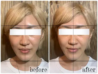 💎後悔させない小顔 矯正💎イトヤマ🌱のエステ・リラクイメージ