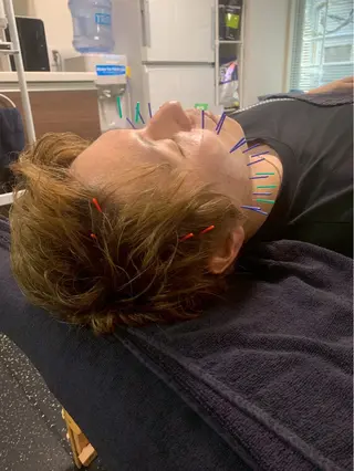 美容鍼・小顔矯正 FLOW 鍼灸整体院のその他イメージ