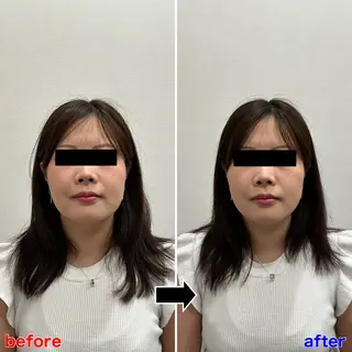 小顔矯正・美容鍼 FLOW鍼灸整体院のエステ・リラクイメージ