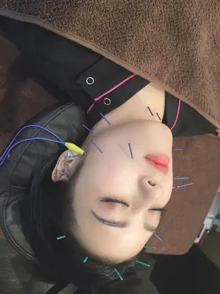 表参道鍼灸院K 美容鍼🔮ララピールのエステ・リラクイメージ