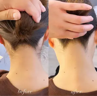 うなじ脱毛/美肌脱毛 LABELのエステ・リラクイメージ