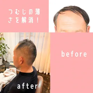 ショート メンズ 薄毛専門 メンズカットREEのヘアスタイル