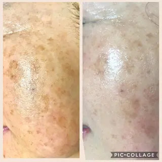 La Chance. Sayakaのエステ・リラクイメージ