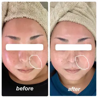 Venus所属・エステサロン Venusのその他イメージ