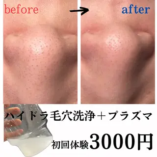 Babel Mirokuのエステ・リラクイメージ