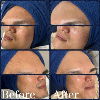 skin make salon -Olu's-所属・毛穴・肌質改善サロン ✨Tomaのその他イメージ