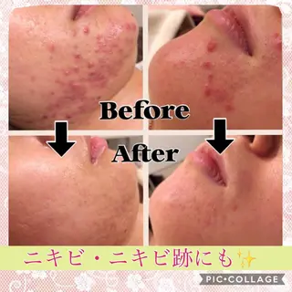 ショート カラー パーマ ヘアアレンジ メンズ キッズ ネイル マツエク・マツパ ニキビ・肌質改善専門 ♡人生が変わるサロンのエステ・リラクイメージ