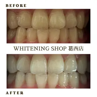 メンズ ホワイトニング ショップ葛西店のその他イメージ