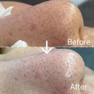 Blue Moon 【ブルームーン】のエステ・リラクイメージ