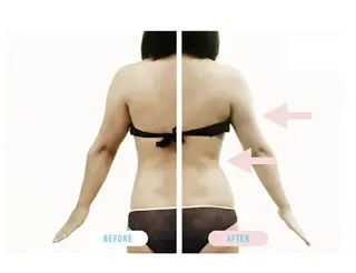 DANDELION ハイフ:脱毛のエステ・リラクイメージ