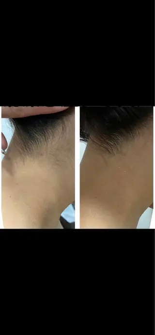 Lumus Solarum所属・Lumus Solarumのエステ・リラクイメージ