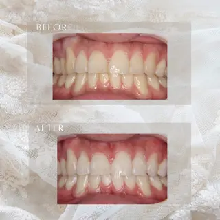 ホワイトニングサロン シロイハ所属・歯を白くしたい方🦷 シロイハのその他イメージ