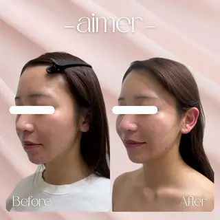 aimer 島田のエステ・リラクイメージ